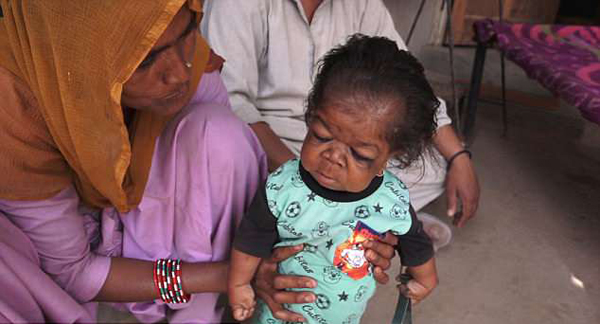 印度怪病最新动态,神秘医疗之旅与美食探索的双重体验