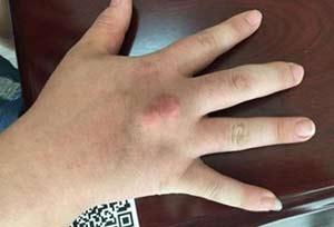 最新病情案例深度探讨