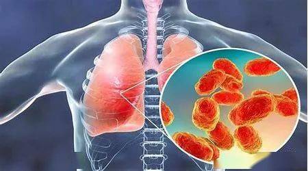 王剑最新肺炎，时代挑战下的启示与应对