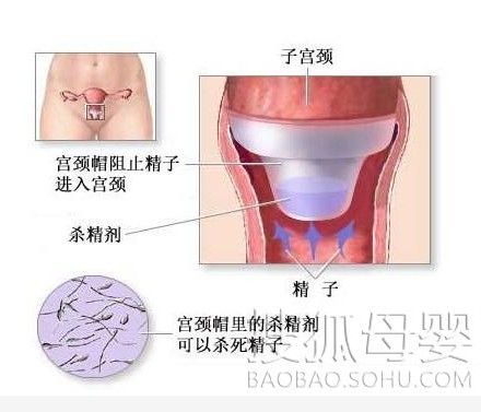 最新避孕方法，变化的力量与自信之旅