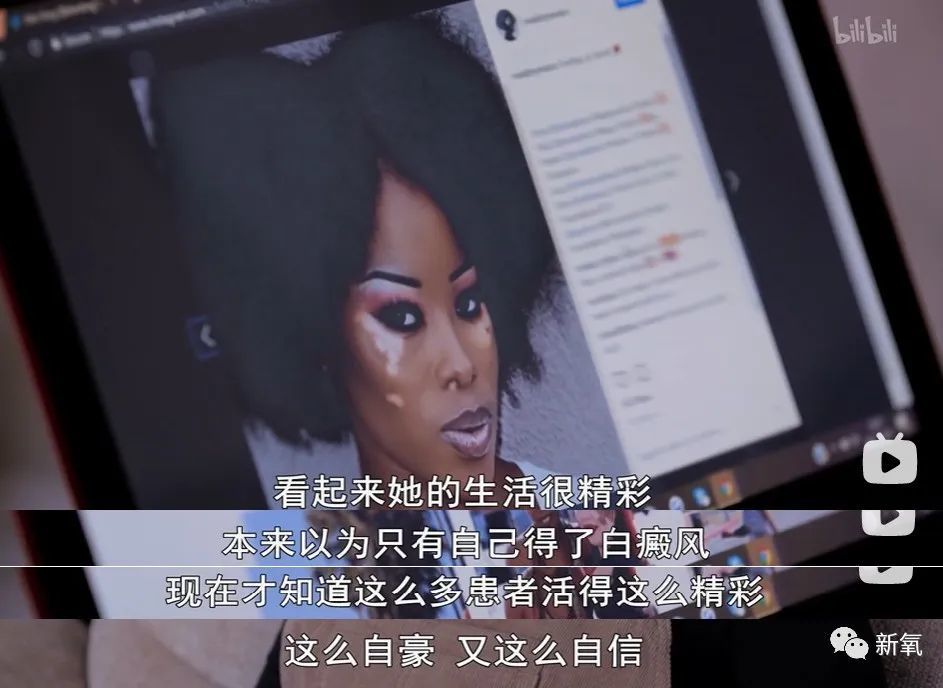 白癜风演员的心灵之旅,与自然美景的轻松对话,探寻内心宁静之路