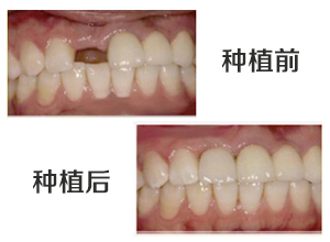 最新牙齿修复技术揭秘，小巷中的隐秘宝藏牙科诊所