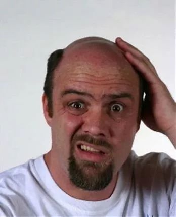 秃顶男潮流指南，最新流行趋势解析