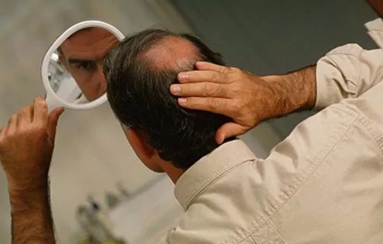 秃顶男潮流指南,最新流行趋势解析